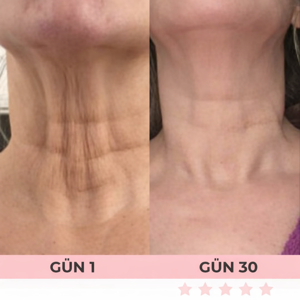 7’si 1 Arada LED Yüz Şekillendirici