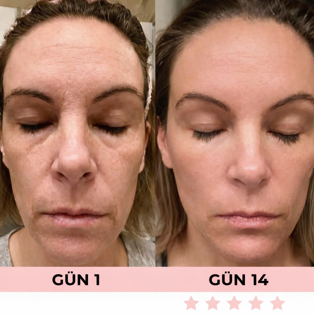 7’si 1 Arada LED Yüz Şekillendirici